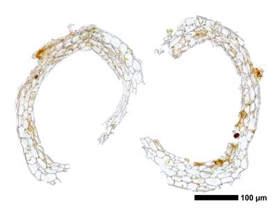 marsupella condensata 1 perigynium mitte quer