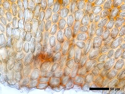 marsupella emarginata 1 flankenblatt blattbasis