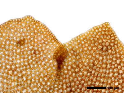 marsupella emarginata 1 flankenblatt blattspitze