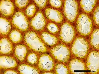 marsupella emarginata 2 flankenblatt blattmitte detail
