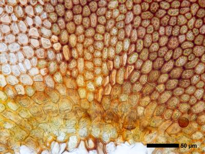 marsupella funckii 1 flankenblatt blattbasis