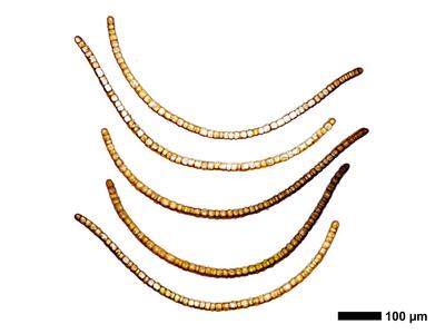 marsupella funckii 1 flankenblatt quer