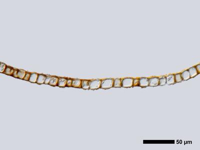 marsupella funckii 1 flankenblatt quer detail
