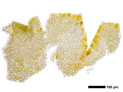 marsupella funckii 1 perianth