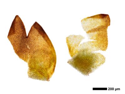 marsupella funckii 1 perigynium