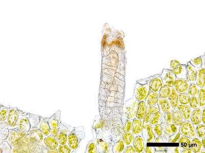 marsupella sprucei 1 archegonium