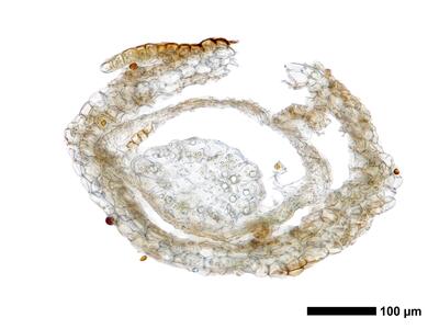 marsupella sprucei 2 perigynium quer