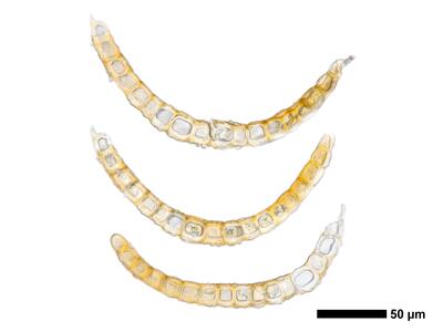eremonotus myriocarpus 1 flankenblatt quer
