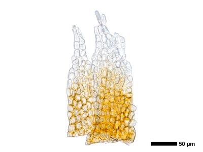 eremonotus myriocarpus 1 perianthmuendung