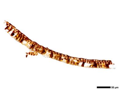 jungermannia atrovirens 2 kapsel quer