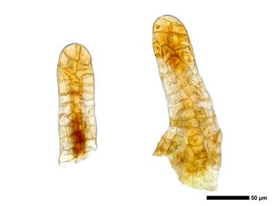 liochlaena lanceolata 2 archegonien