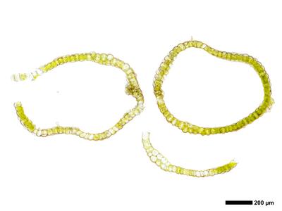 liochlaena lanceolata 2 perianth basis quer