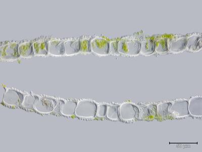 mesoptychia bantriensis ssp bantriensis blatt quer detail