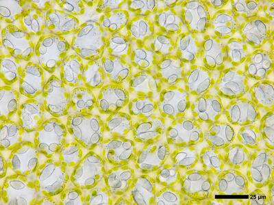 mesoptychia collaris 2 flankenblatt blattmitte