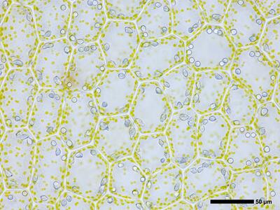 chiloscyphus pallescens 2 flankenblatt blattmitte