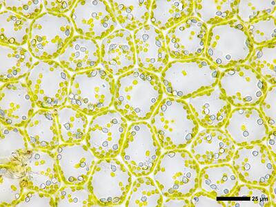 chiloscyphus pallescens 3 flankenblatt blattmitte detail
