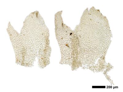 chiloscyphus polyanthos 1 apical perianth
