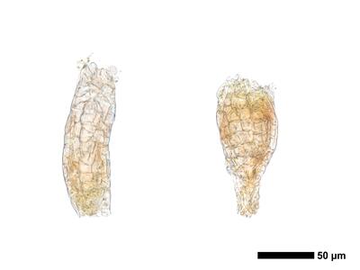 chiloscyphus polyanthos 1 archegonien