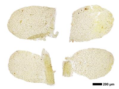 chiloscyphus polyanthos 1 flankenblatt