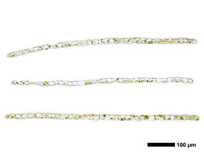chiloscyphus polyanthos 1 flankenblatt quer
