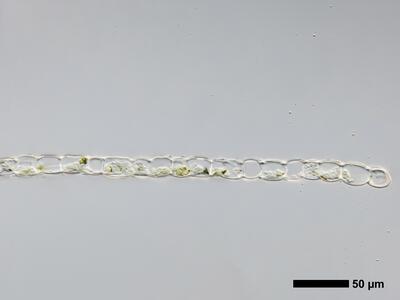 chiloscyphus polyanthos 1 flankenblatt quer detail
