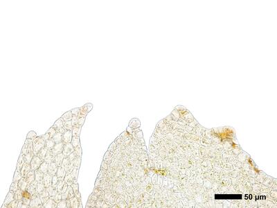 chiloscyphus polyanthos 1 perianthmuendung