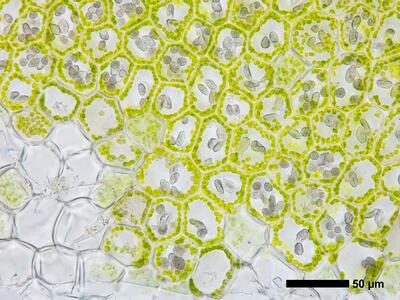 chiloscyphus polyanthos 2 flankenblatt blattbasis