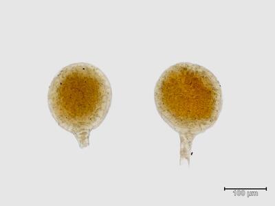 heterogamma capitata antheridien