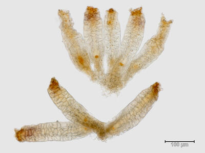 heterogamma capitata archegonien