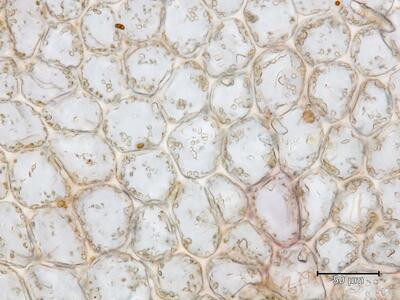 heterogamma capitata flankenblatt blattmitte