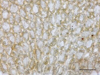 lophozia ascendens 1 flankenblatt blattbasis