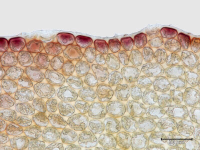 lophozia ascendens 1 flankenblatt blattrand