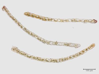 lophozia ascendens 1 flankenblatt quer