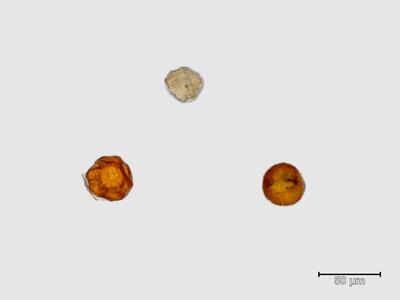 lophozia ascendens 1 sporen