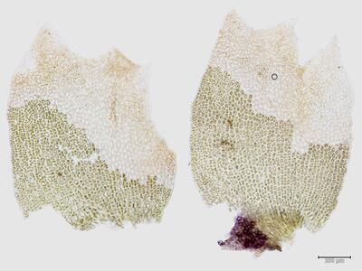 lophozia ascendens 1 weibliche braktee