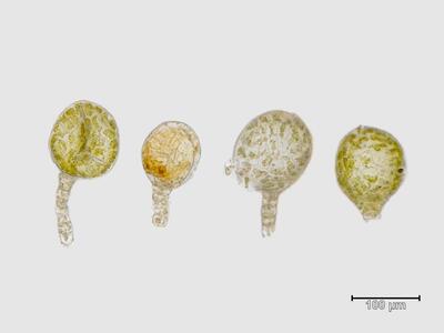 lophozia excisa antheridien