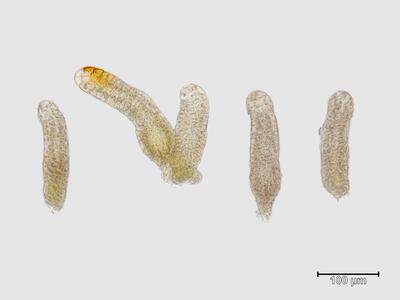 lophozia excisa archegonien
