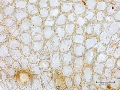 lophozia excisa flankenblatt blattbasis