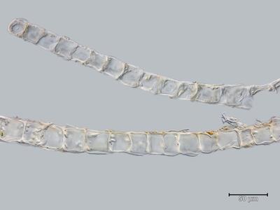 lophozia excisa flankenblatt quer detail