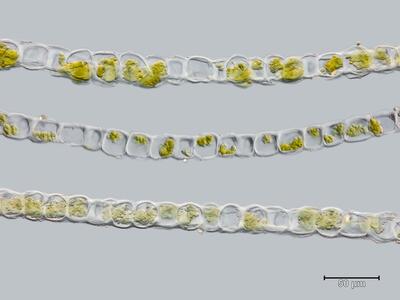 lophozia grandiretis flankenblatt quer detail