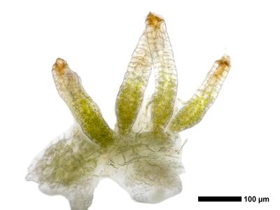 lophozia guttulata frisch archegonien