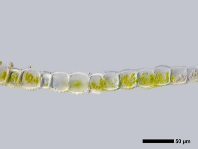 lophozia guttulata frisch flankenblatt quer detail