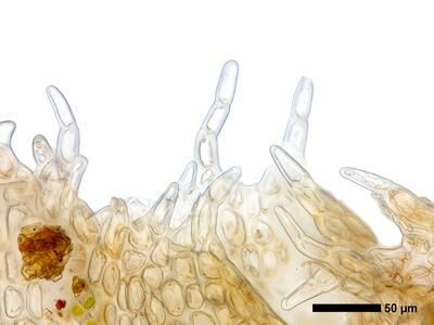 lophozia guttulata frisch perianthmuendung detail