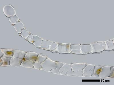 lophozia incisa 1 flankenblatt quer detail