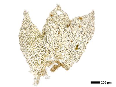 lophozia incisa 1 perichaetialblatt mann