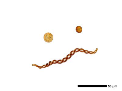 lophozia incisa 1 sporen elateren