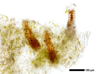 lophozia incisa 2 archegonien