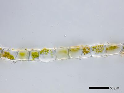 lophozia incisa 2 flankenblatt quer detail