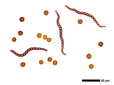 lophozia incisa 2 sporen elateren