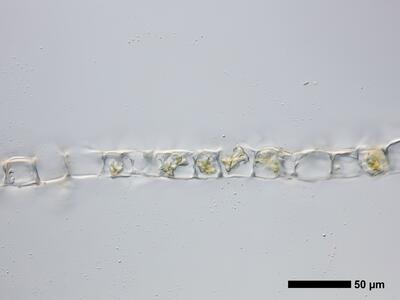 lophozia longidens 1 flankenblatt quer detail